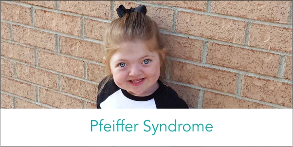 pfeiffer-syndrome