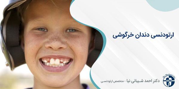 ارتودنسی دندان خرگوشی